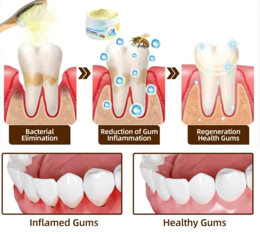 𝐎𝐲𝐢𝐤𝐞𝐲™ Focussmile Bee Venom Treatment Oral Powder