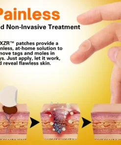 AEXZR™ Bee Venom -🇺🇸𝕊𝕒𝕧𝕖 🇺🇵 𝕥𝕠 8️⃣0️⃣% 𝕥𝕠𝕕𝕒𝕪🗽- Tags & Moles Remover Patches