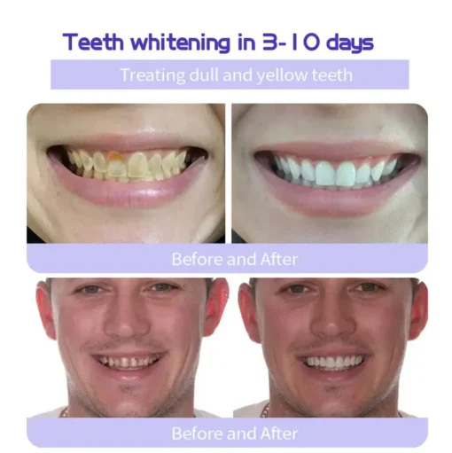 AEXZR™ Teeth Restoration Mineral Powder - UP TO 50% OFF