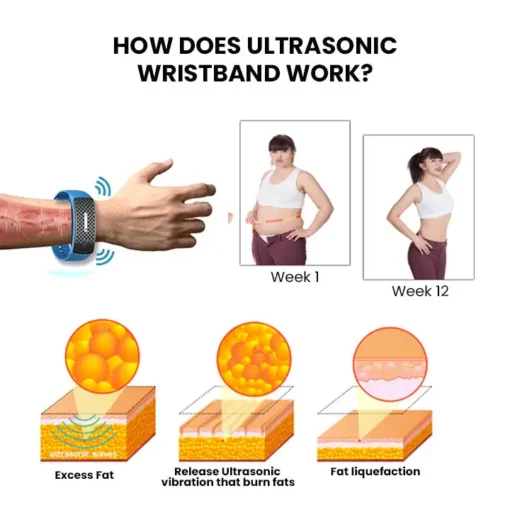 Histone™ Matteo Ultrasonic Body Shape Wristband Pro