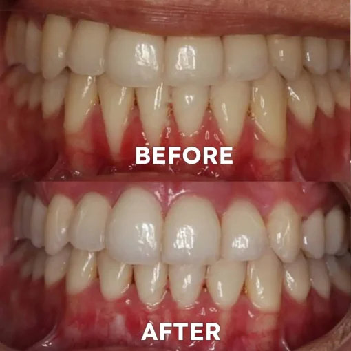 Ourlyard™ Teeth Restoration Mineral Powder - Image 6