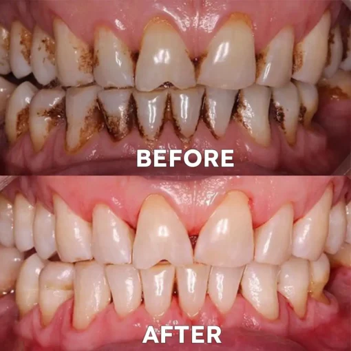 Ourlyard™ Teeth Restoration Mineral Powder - Image 7