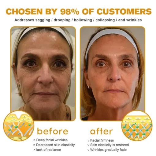 𝗧𝗟𝗢𝗣𝗔® Botox Bee Venom Wrinkle Removal Cream