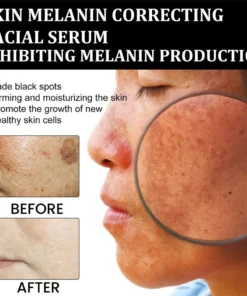 ADFIRE™ Melanin Correcting Facial Serum