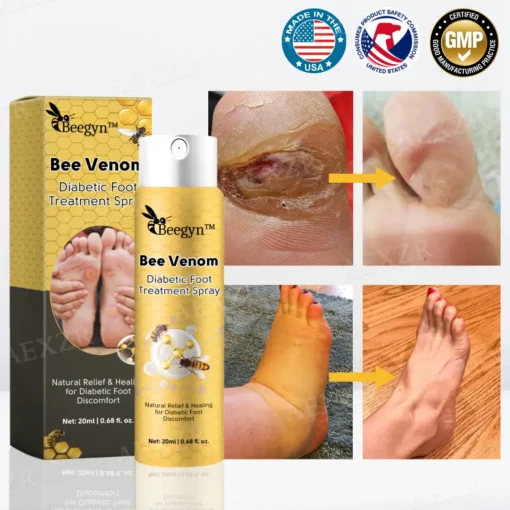 Beegyn™ Bee Venom Diabetic Foot Treatment Spray