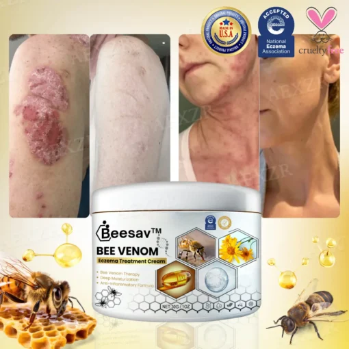 Beesav™ Bee Venom Eczema Treatment Cream